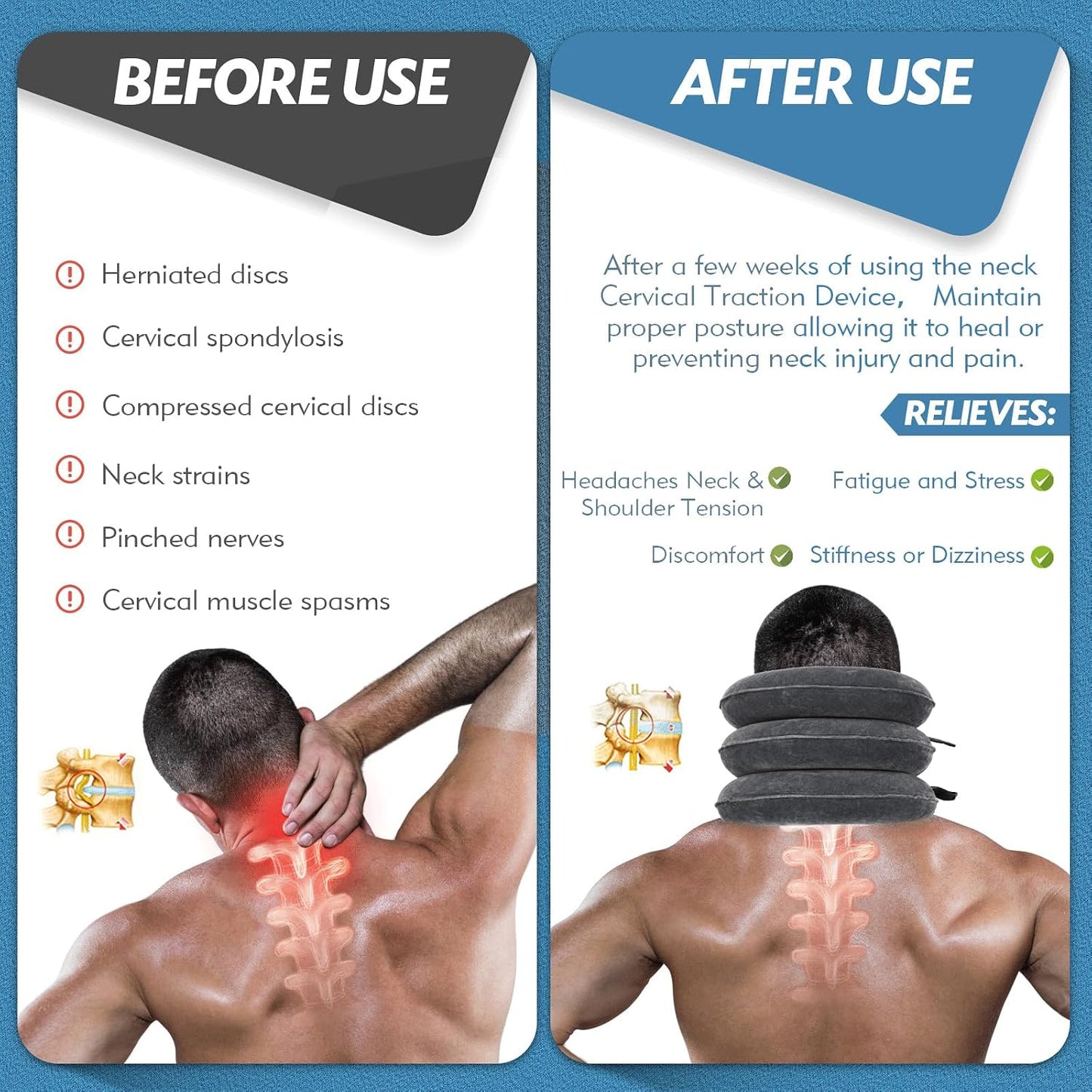 Neck Stretcher, Neck Traction Device for Instant Neck Pain Relief