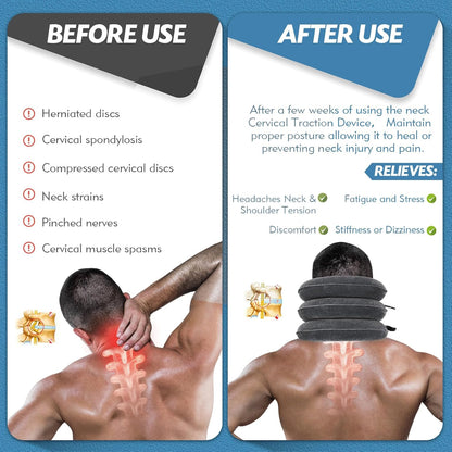 Neck Stretcher, Neck Traction Device for Instant Neck Pain Relief