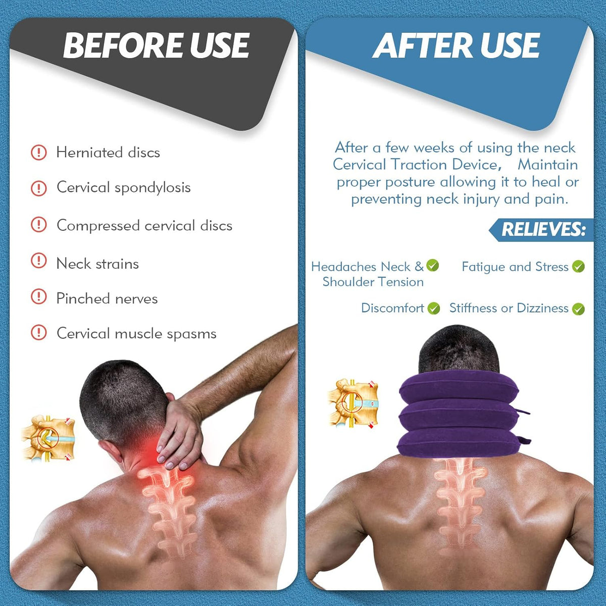 Neck Stretcher, Neck Traction Device for Instant Neck Pain Relief