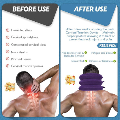 Neck Stretcher, Neck Traction Device for Instant Neck Pain Relief