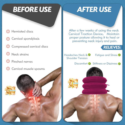 Neck Stretcher, Neck Traction Device for Instant Neck Pain Relief
